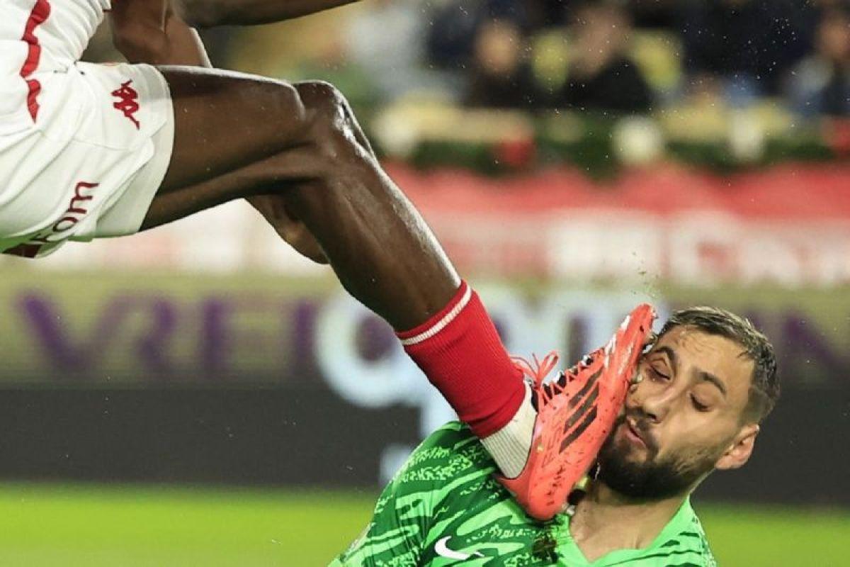  Penjaga Gawang PSG Alami Cedera Wajah Serius Saat Bertanding Lawan Monaco